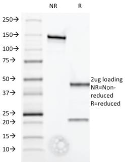 Mouse anti-IFN-alpha 1, Clone: 2.52, Novus Biologicals:Antibodies:Primary